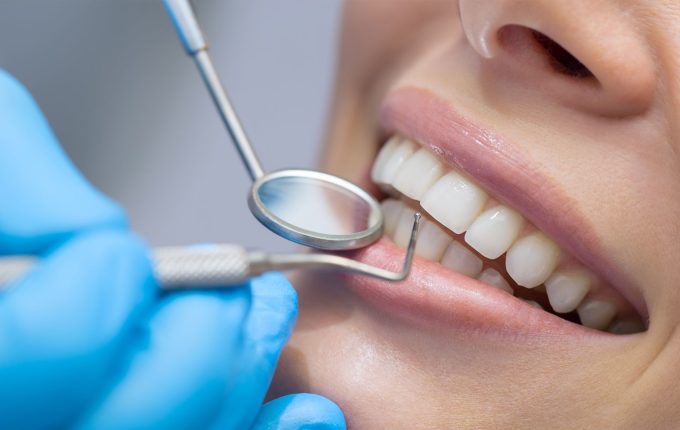 Dental teeth cleaning by a hygienist