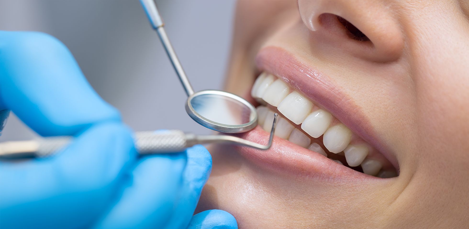 Dental teeth cleaning by a hygienist