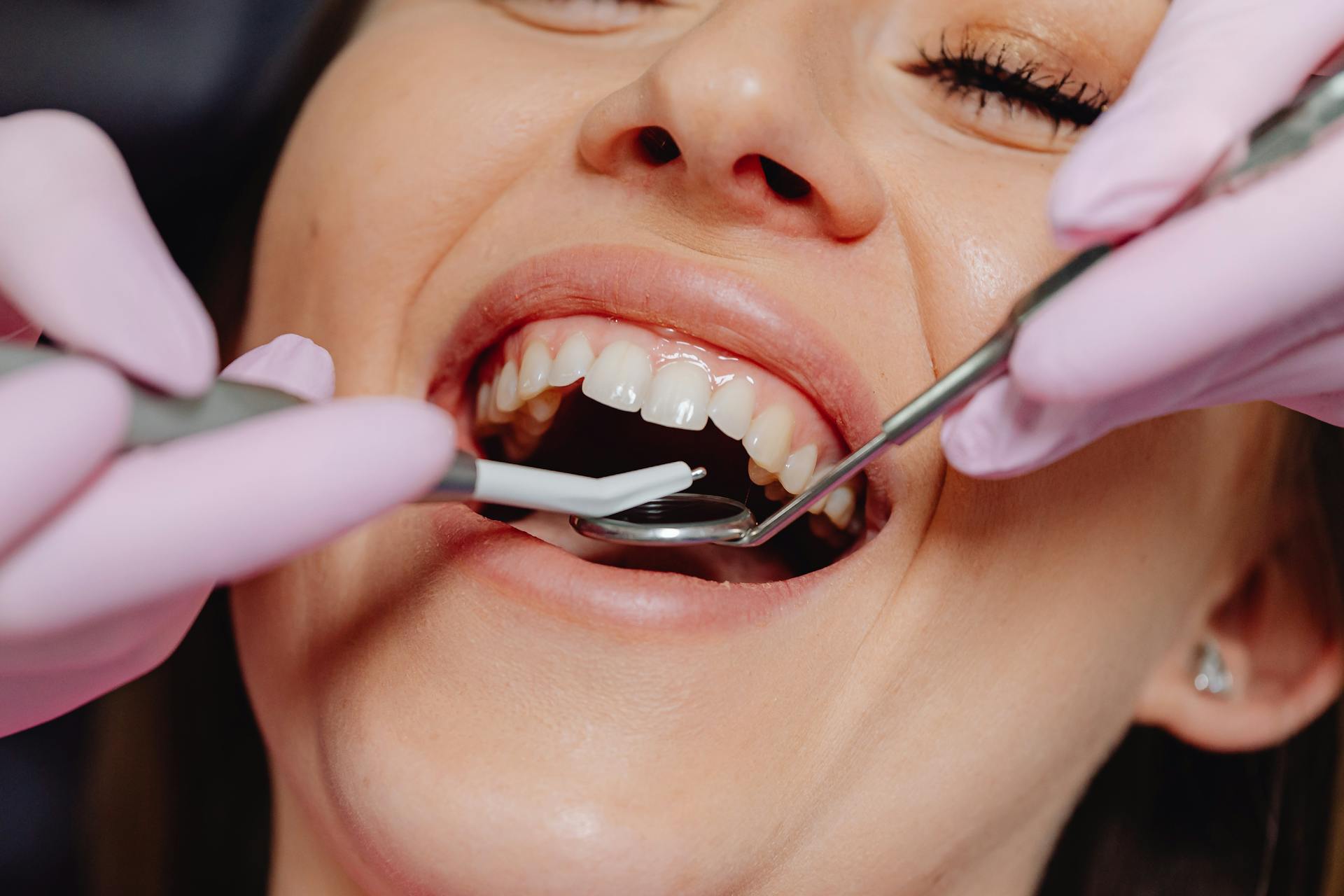 A dentist answering the question “Is gum recession normal?” while examining a patient