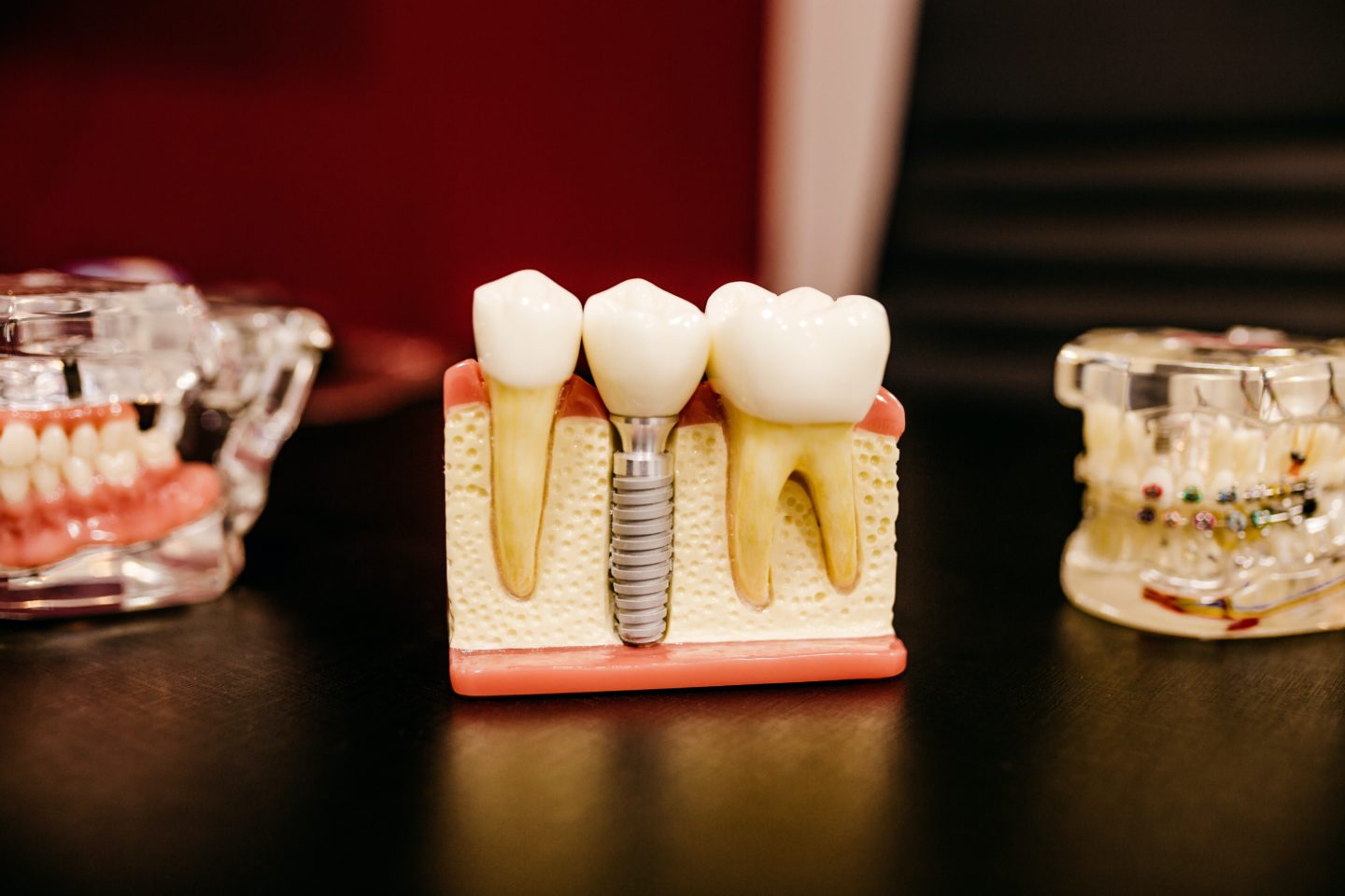 insurance for preventative dental care