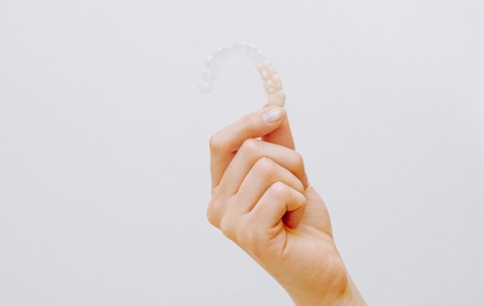 clear aligner