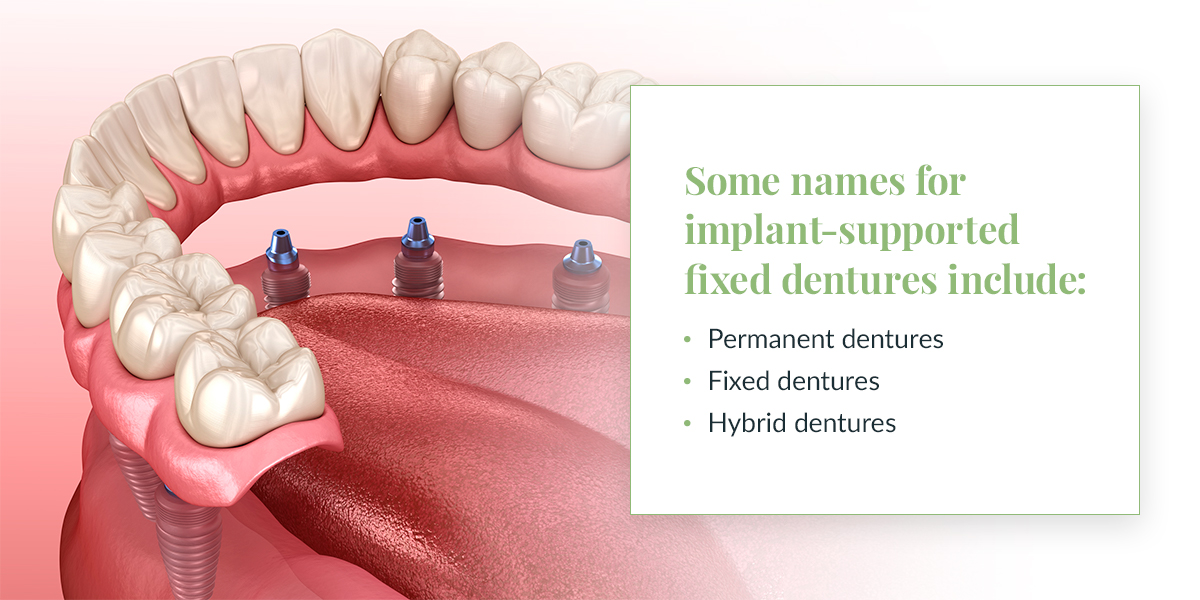 Implant-Supported Fixed Denture