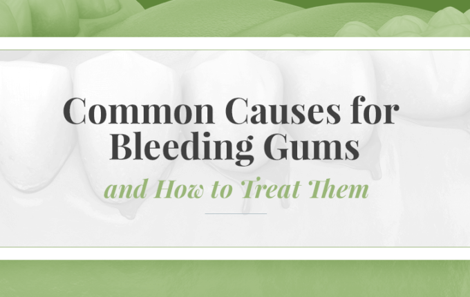 Common Causes for Bleeding Gums