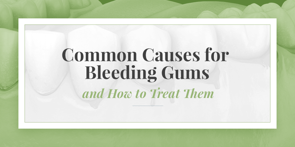 Common Causes for Bleeding Gums