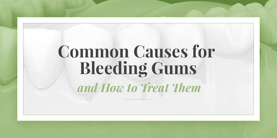 Common Causes for Bleeding Gums & Treatment