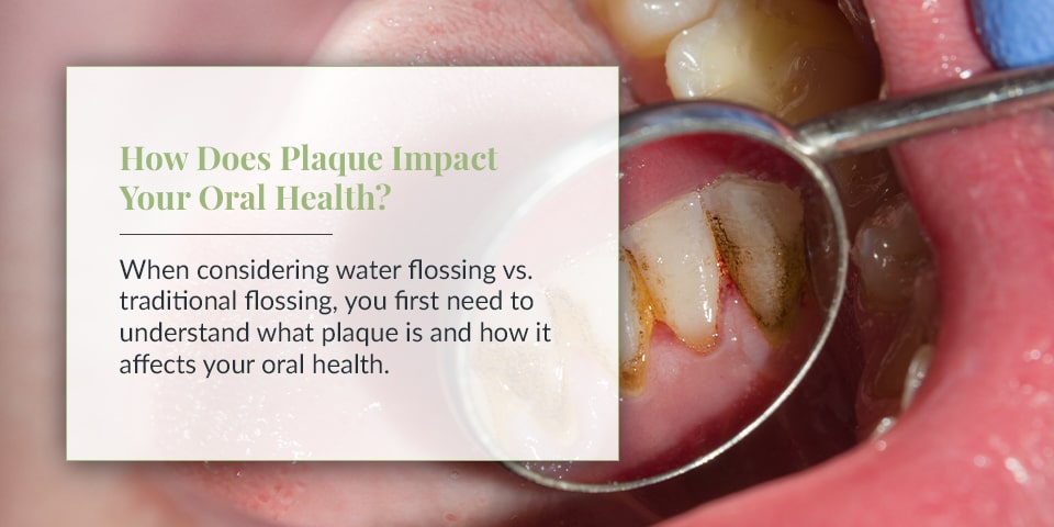 How Does Plaque Impact Your Oral Health?