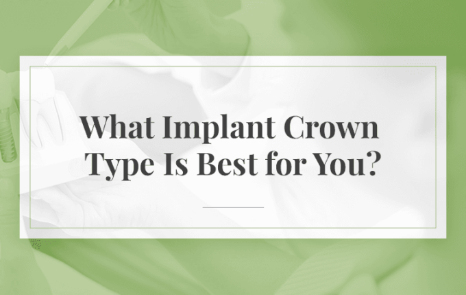 What Implant Crown Type Is Best for You?