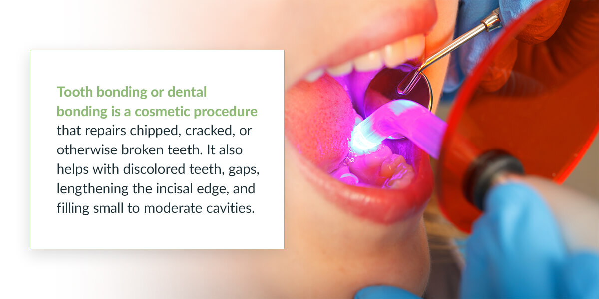 What Is Teeth Bonding, and Why Is It Performed?