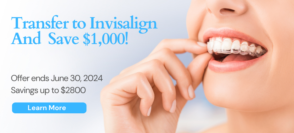 Transfer to Invisalign from another clear retainers treatment & save $1000 until June 30, 2024