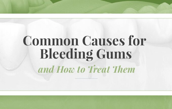 Common causes of bleeding gums and how to treat them, illustrated with a healthy teeth background