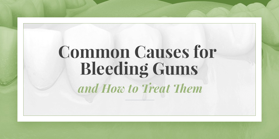 Common causes of bleeding gums and how to treat them, illustrated with a healthy teeth background