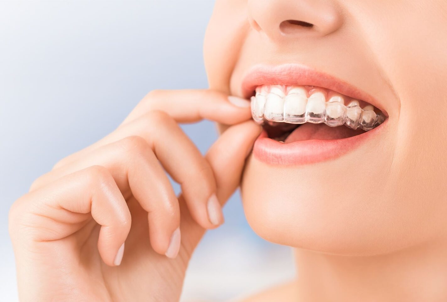 A person wearing retainers