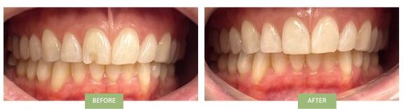 emergency dentist near me