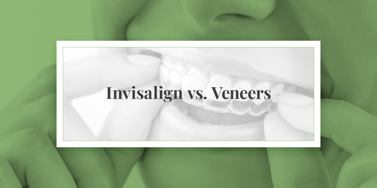 A person placing an Invisalign aligner in their mouth