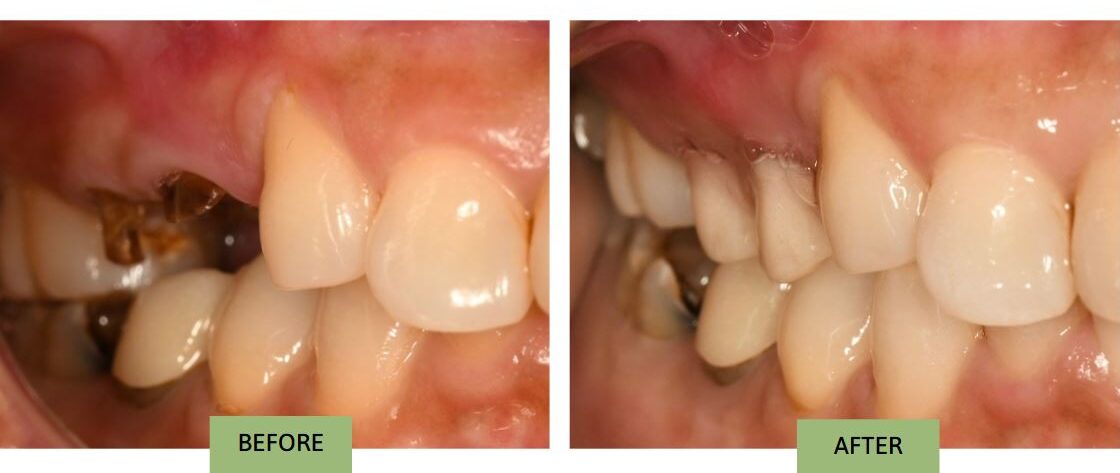 Before-after-Dr.Liang-2