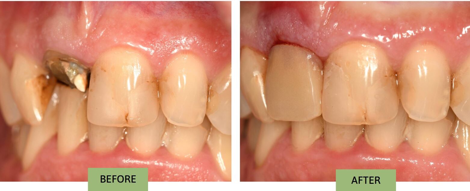 Before-after-Dr. Michelle Liang