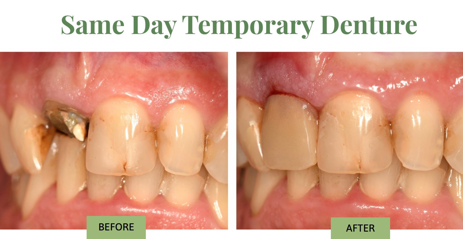Before-after-Dr. Michelle Liang
