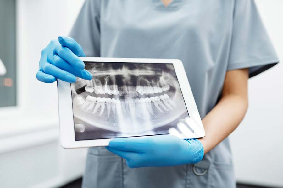 A dentist holding a tablet that displays digital dental X-Rays in NYC