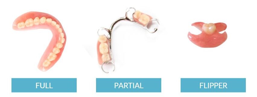 types of removable dentures