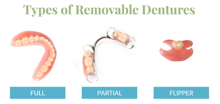 types of removable dentures
