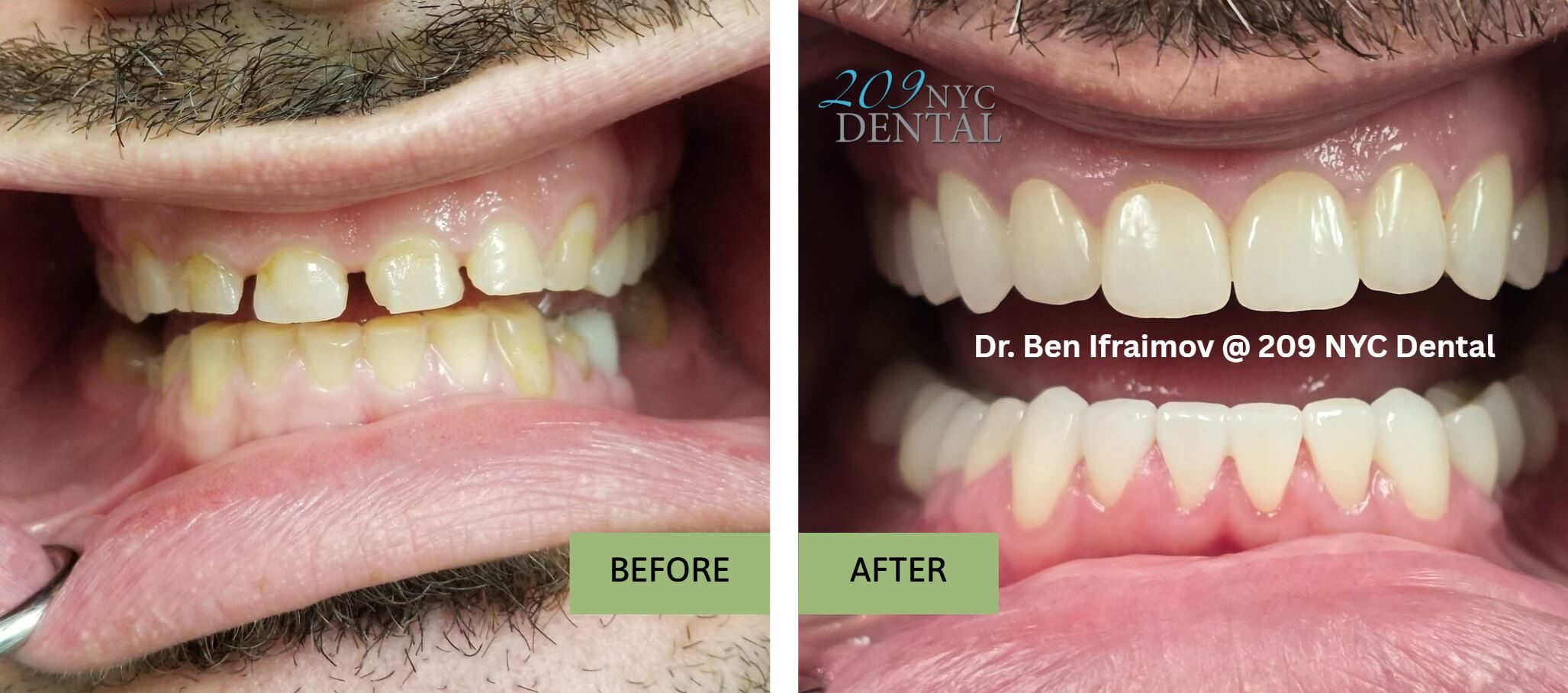 Before and after dental images demonstrating significant cosmetic improvements.