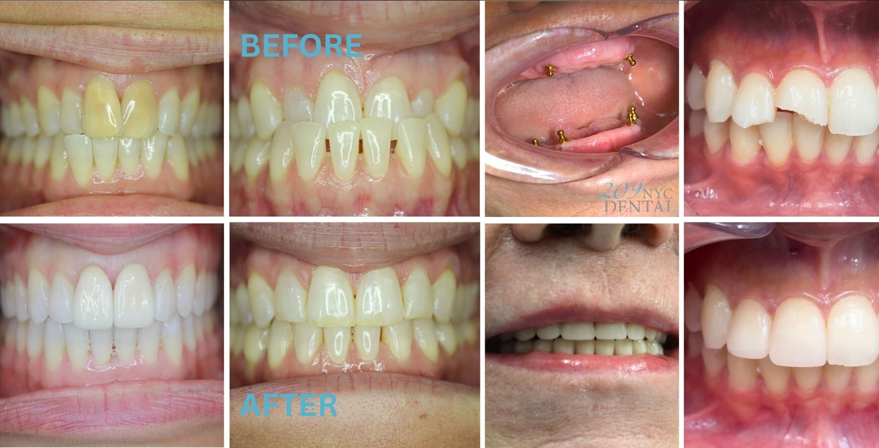 multi-specialty care before and after images